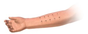 skin test illustration
